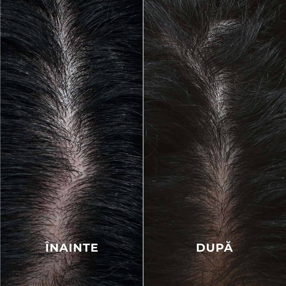 Cură intensivă pentru creșterea densității părului